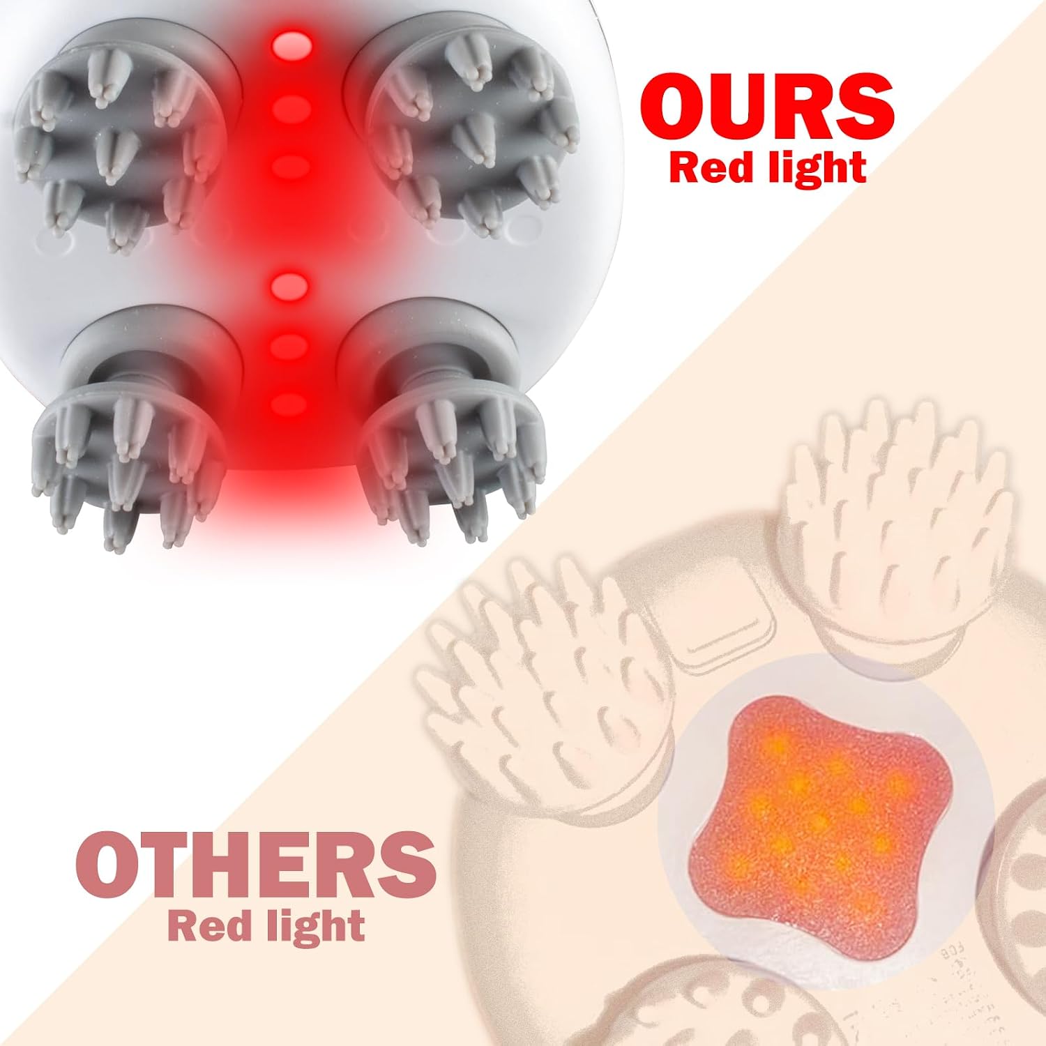 Electric Scalp Massager – Red Light Care & 4 Massage Modes